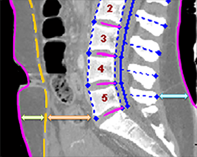 central plane depths