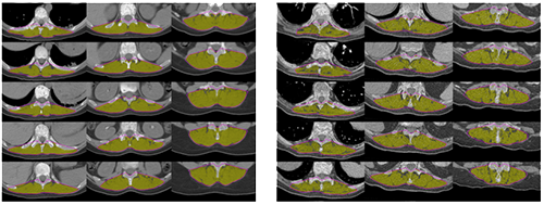 Dorsal muscle Group