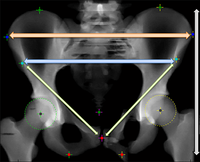 Pelvis (sizes)