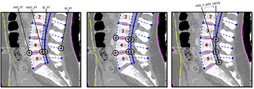 Spinal Measures (angles & sizes)